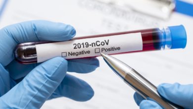 Photo of Ministerstwo Zdrowia: ostatniej doby wykonano ponad 47,4 tys. testów na koronawirusa