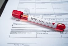 Photo of Ministerstwo Zdrowia: 322 laboratoria wykonują w Polsce testy na koronawirusa